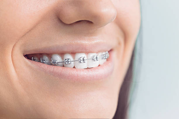 Best Wisdom Tooth Removal  in Soh Ogden, UT